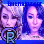 Hazel A Before Surgery Hazel A Before Surgery